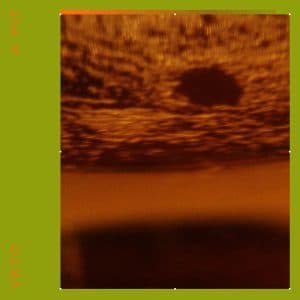 Album cover art for "A Pit" by VETO