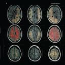 Contagion Model Cover Art