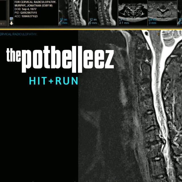 Hit & Run (EP)