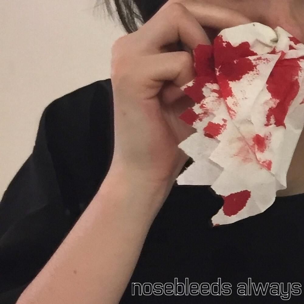 ​nosebleeds always