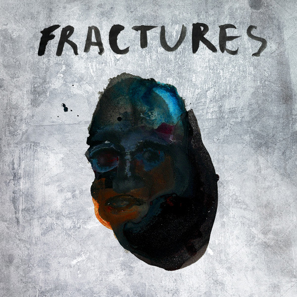 Fractures 