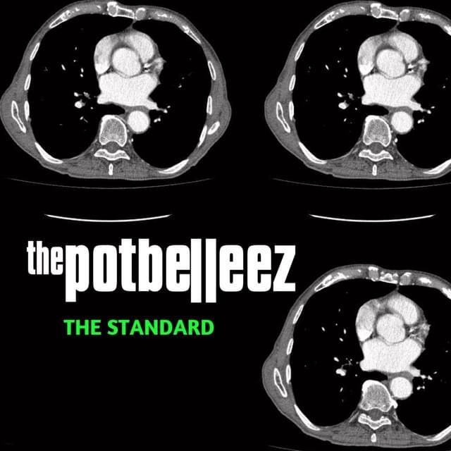The Standard (EP)