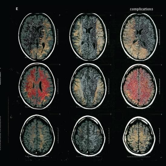 Complications Cover Art