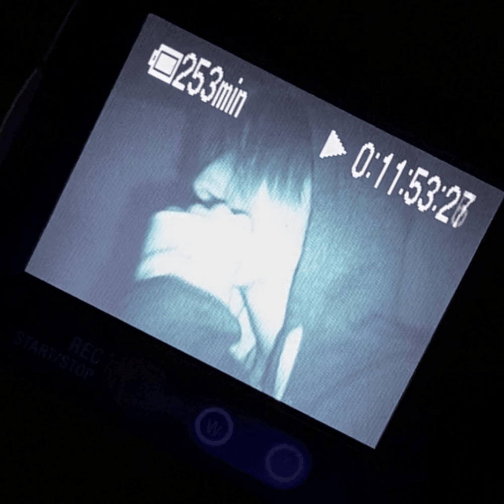anhedonia