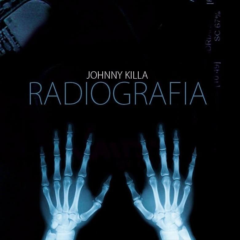Radiografia - EP